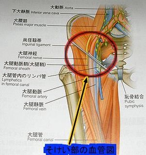 sokei-kekkan.jpg